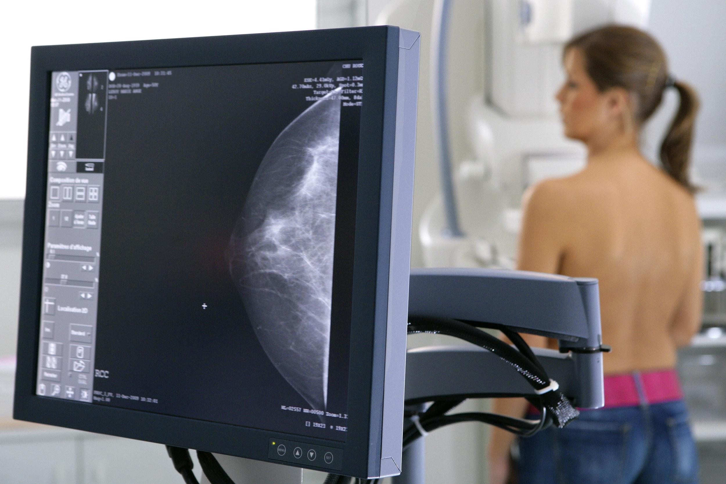 преимущества цифровой маммографии