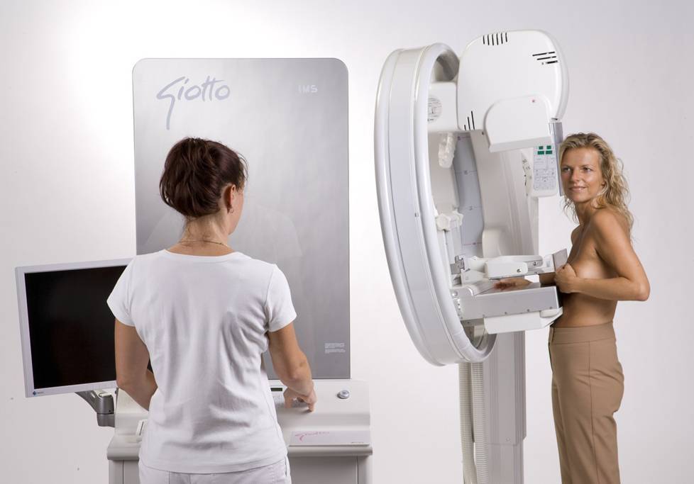 маммограф GIOTTO IMAGE 3D