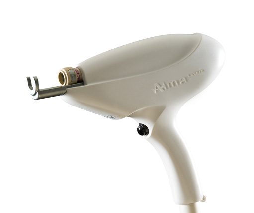 Лазерная коррекция сосудов АЛЬМА-ЛАЗЕР- удаление сосудистых звездочек в Медицинском центре "Звезда", цена Казань