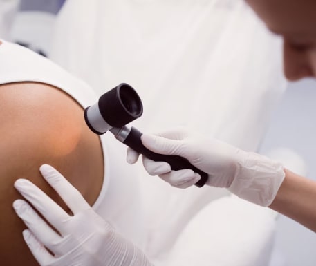 Удаление папиллом