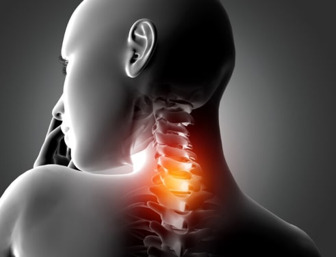 Рентген шеи и шейного отдела в Казани (ШОП) — сделать рентген с функциональными пробами в двух проекциях в медицинском центре "Звезда", цена