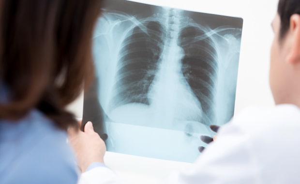 Рентген легких в Казани - цены в медицинском центре Звезда