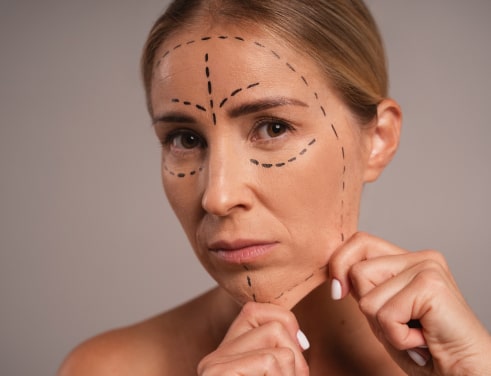 Подтяжка нитями Аптос