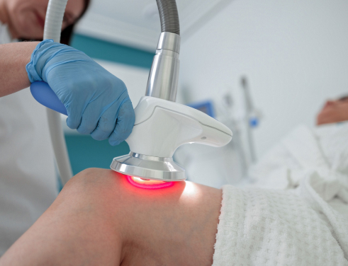 Лазеротерапия